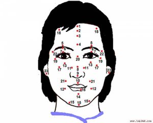 nốt ruồi trên mặt